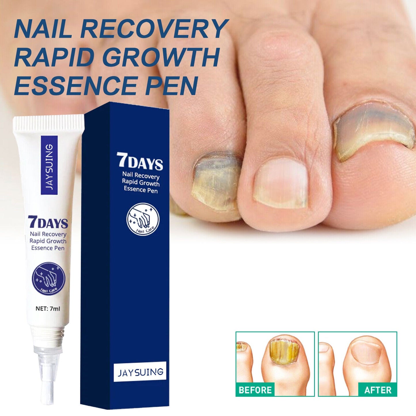 7 Days Nail Recovery Rapid Growth Essence Pen