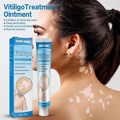 Original TreatVitiligo Soothing Cream